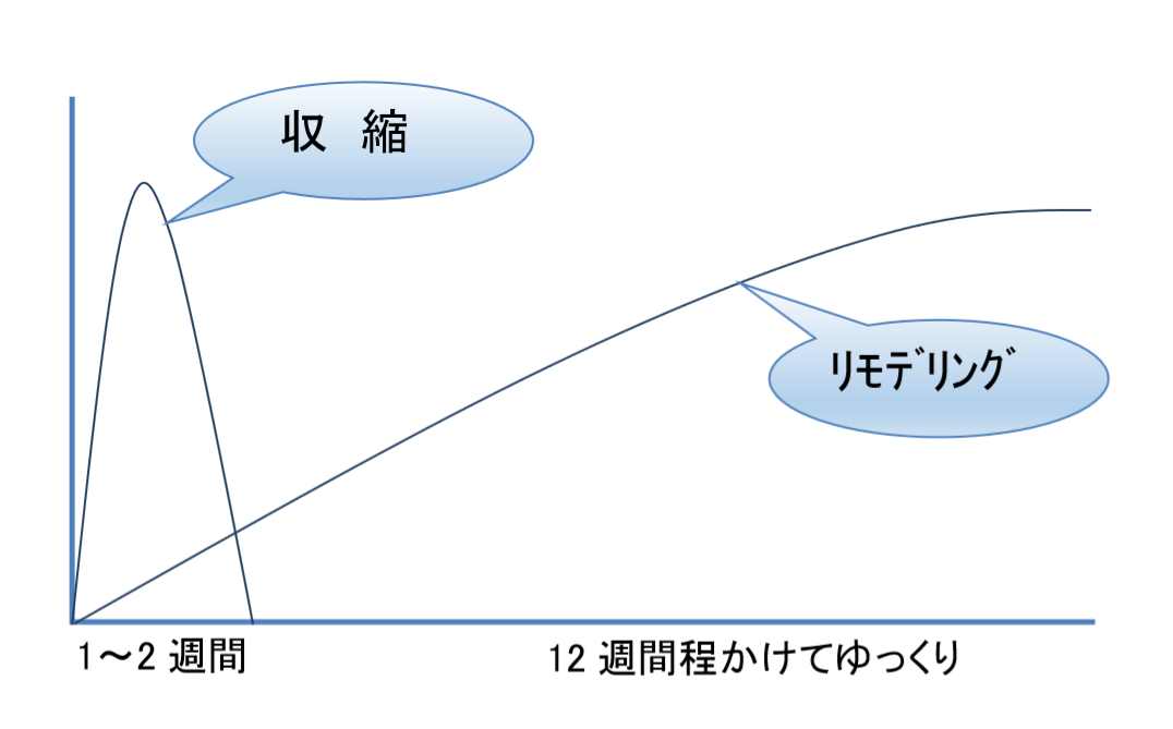 サーマクール,イントラジェン,イントラゲン,奈良,たるみ