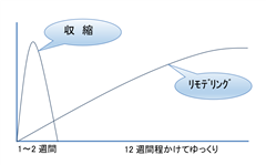 サーマクール,イントラジェン,イントラゲン,奈良,たるみ